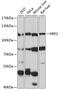 Nuclear Factor, Erythroid 2 Like 2 antibody, 13-240, ProSci, Western Blot image 