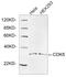 Cyclin Dependent Kinase 5 antibody, LS-C203160, Lifespan Biosciences, Western Blot image 