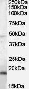 BAALC Binder Of MAP3K1 And KLF4 antibody, NB100-2413, Novus Biologicals, Western Blot image 