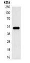 Keratin 17 antibody, LS-B16512, Lifespan Biosciences, Immunoprecipitation image 