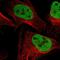 SWI/SNF Related, Matrix Associated, Actin Dependent Regulator Of Chromatin Subfamily C Member 2 antibody, NBP1-90017, Novus Biologicals, Immunofluorescence image 