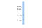 Tyrosine 3-Monooxygenase/Tryptophan 5-Monooxygenase Activation Protein Theta antibody, 31-026, ProSci, Western Blot image 