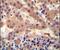 Haptoglobin antibody, PA5-24174, Invitrogen Antibodies, Immunohistochemistry paraffin image 