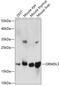 ORMDL Sphingolipid Biosynthesis Regulator 3 antibody, GTX66313, GeneTex, Western Blot image 