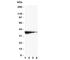 Toll Like Receptor Adaptor Molecule 1 antibody, R31108, NSJ Bioreagents, Western Blot image 