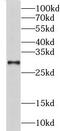 Charged Multivesicular Body Protein 6 antibody, FNab01661, FineTest, Western Blot image 