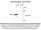 P21 (RAC1) Activated Kinase 1 antibody, NBP2-29511, Novus Biologicals, Western Blot image 