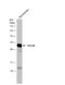 Glutamate-Cysteine Ligase Modifier Subunit antibody, NBP2-16624, Novus Biologicals, Western Blot image 