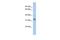 Family With Sequence Similarity 92 Member B antibody, GTX45169, GeneTex, Western Blot image 