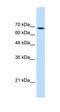 Transglutaminase 2 antibody, orb330509, Biorbyt, Western Blot image 