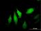 Dynein Axonemal Light Intermediate Chain 1 antibody, H00007802-B01P, Novus Biologicals, Immunofluorescence image 