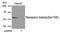 Estrogen Receptor 2 antibody, GTX55407, GeneTex, Western Blot image 