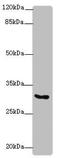Potassium Voltage-Gated Channel Interacting Protein 2 antibody, LS-C682124, Lifespan Biosciences, Western Blot image 