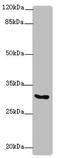 Kv channel-interacting protein 2 antibody, LS-C682124, Lifespan Biosciences, Western Blot image 