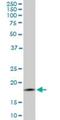 Translocase Of Outer Mitochondrial Membrane 22 antibody, H00056993-M01, Novus Biologicals, Western Blot image 