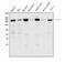 Clathrin Heavy Chain antibody, A03134-1, Boster Biological Technology, Western Blot image 