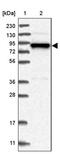 Adducin 3 antibody, PA5-57369, Invitrogen Antibodies, Western Blot image 