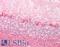 Neurofilament Heavy antibody, LS-B11845, Lifespan Biosciences, Immunohistochemistry paraffin image 