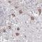 Paired Like Homeodomain 3 antibody, HPA044639, Atlas Antibodies, Immunohistochemistry paraffin image 