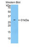 Pitrilysin Metallopeptidase 1 antibody, LS-C295923, Lifespan Biosciences, Western Blot image 