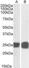 Growth Factor Receptor Bound Protein 2 antibody, 45-066, ProSci, Western Blot image 