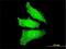 Orthodenticle Homeobox 1 antibody, H00005013-M06, Novus Biologicals, Immunocytochemistry image 