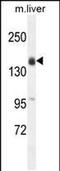 Otoancorin antibody, PA5-48131, Invitrogen Antibodies, Western Blot image 