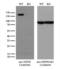 Neurofilament Medium antibody, LS-C798285, Lifespan Biosciences, Western Blot image 