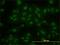Kruppel Like Factor 11 antibody, H00008462-M01, Novus Biologicals, Immunofluorescence image 