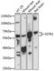 Somatostatin Receptor 2 antibody, 18-958, ProSci, Western Blot image 