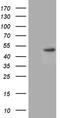 Chitinase Acidic antibody, CF811227, Origene, Western Blot image 