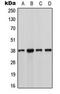 Casein Kinase 1 Alpha 1 antibody, MBS8227893, MyBioSource, Western Blot image 