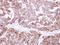 Fumarate Hydratase antibody, NBP1-32893, Novus Biologicals, Immunohistochemistry paraffin image 