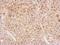 Cytokine Induced Apoptosis Inhibitor 1 antibody, GTX113988, GeneTex, Immunohistochemistry paraffin image 