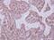 Dihydrouridine Synthase 2 antibody, PA5-31853, Invitrogen Antibodies, Immunohistochemistry paraffin image 