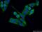 Rho Guanine Nucleotide Exchange Factor 5 antibody, 11379-1-AP, Proteintech Group, Immunofluorescence image 