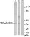 Protein Kinase AMP-Activated Non-Catalytic Subunit Gamma 1 antibody, PA5-38630, Invitrogen Antibodies, Western Blot image 