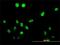 Testis Specific Serine Kinase 1B antibody, H00083942-M02, Novus Biologicals, Immunofluorescence image 