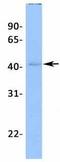 Potassium Two Pore Domain Channel Subfamily K Member 13 antibody, GTX47656, GeneTex, Western Blot image 