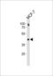 Estrogen Receptor 2 antibody, LS-C157730, Lifespan Biosciences, Western Blot image 