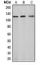 Cbl Proto-Oncogene antibody, MBS821379, MyBioSource, Western Blot image 