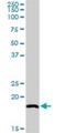 Sorting Nexin 12 antibody, H00029934-D01P, Novus Biologicals, Western Blot image 