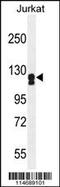 Adenylate Cyclase 2 antibody, 55-781, ProSci, Western Blot image 