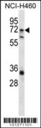 ST6 N-Acetylgalactosaminide Alpha-2,6-Sialyltransferase 1 antibody, 56-398, ProSci, Western Blot image 