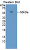 Toll Like Receptor Adaptor Molecule 2 antibody, LS-C374903, Lifespan Biosciences, Western Blot image 