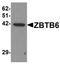 Zinc Finger And BTB Domain Containing 6 antibody, orb75551, Biorbyt, Western Blot image 