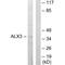 ALX Homeobox 3 antibody, A10111, Boster Biological Technology, Western Blot image 