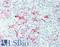 Mesothelin antibody, LS-B10593, Lifespan Biosciences, Immunohistochemistry frozen image 