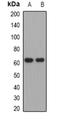 ADCYAP Receptor Type I antibody, orb377902, Biorbyt, Western Blot image 