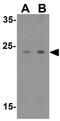 Immunity Related GTPase M antibody, GTX85038, GeneTex, Western Blot image 